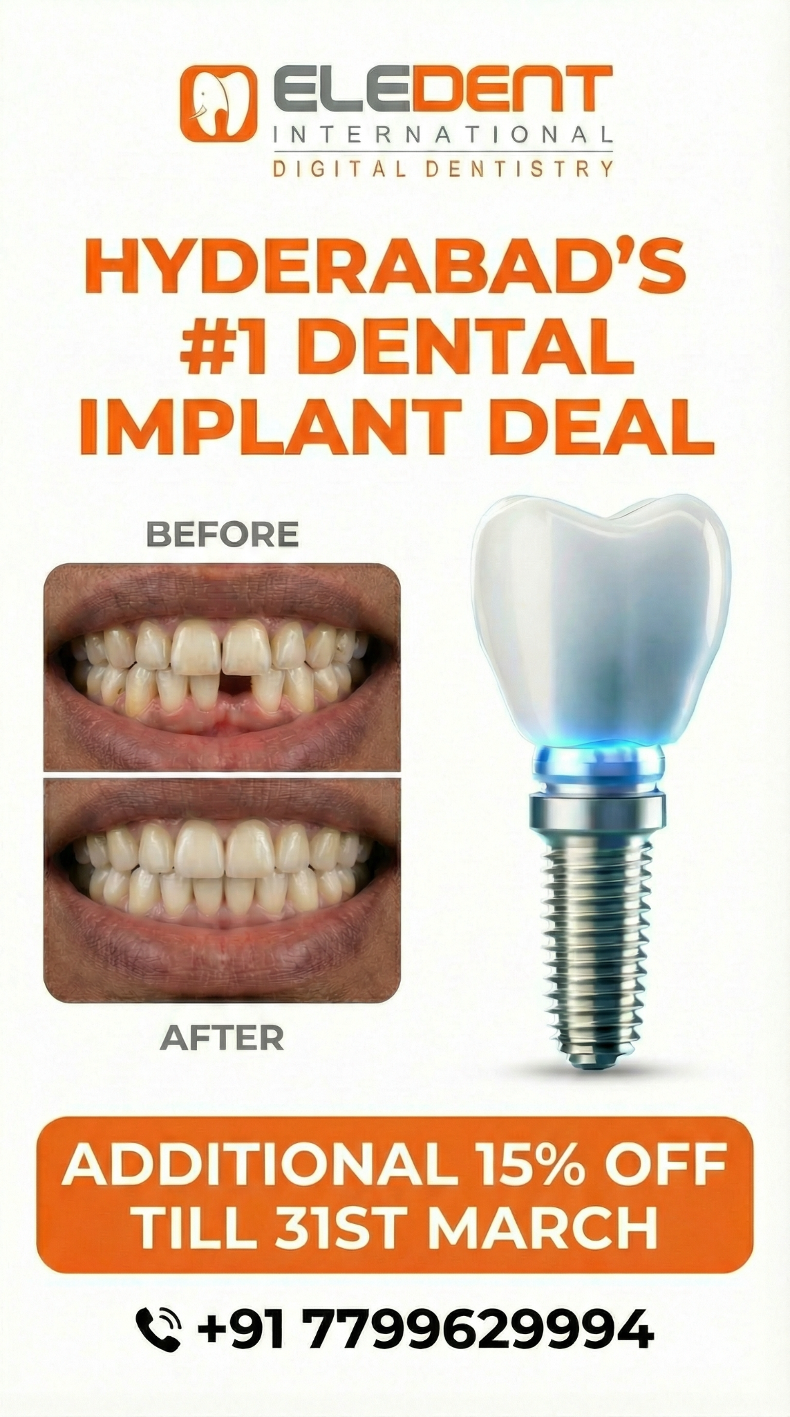 Eledent Dental Hospitals Facebook ad