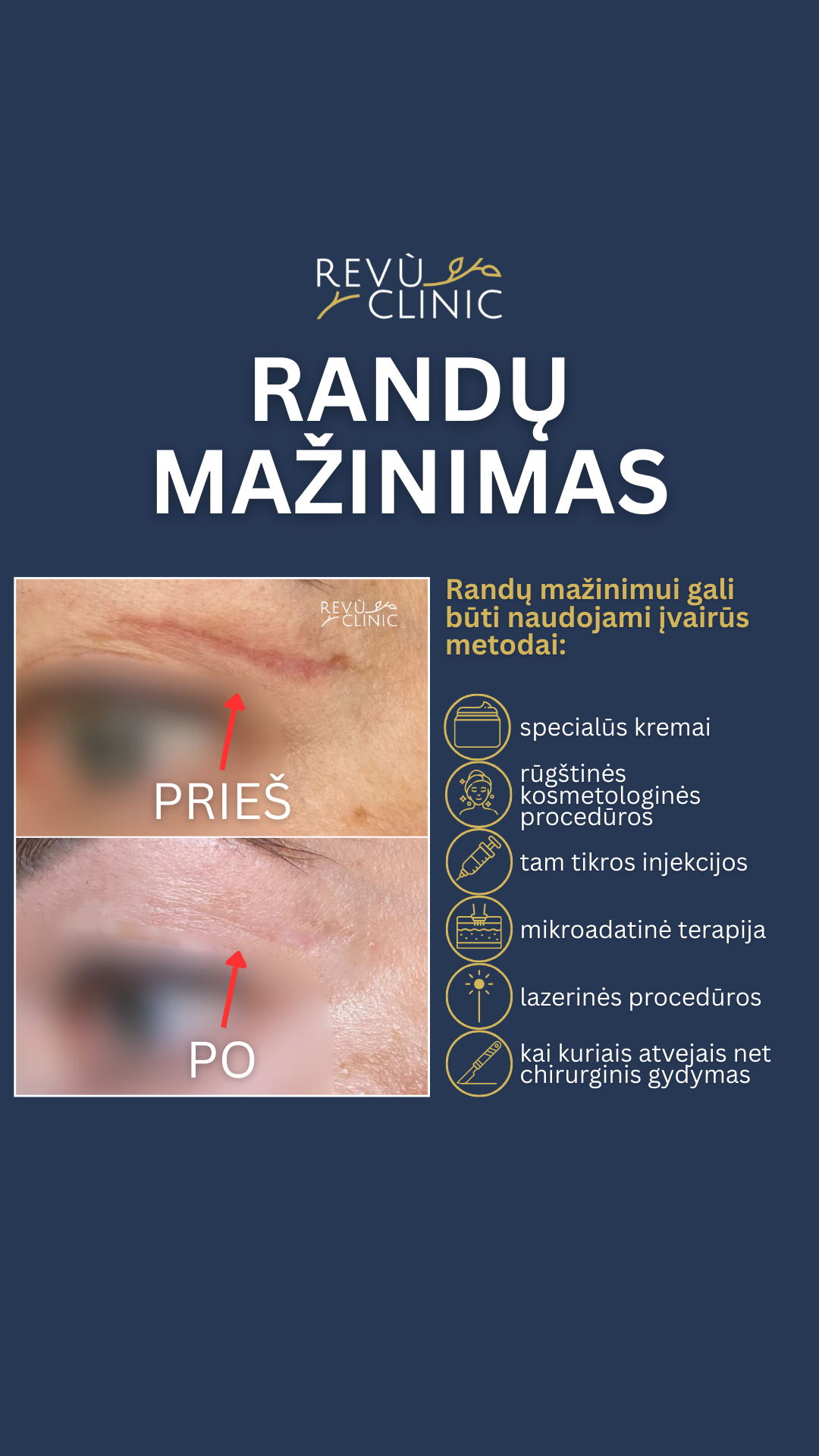 REVÙ CLINIC Facebook ad