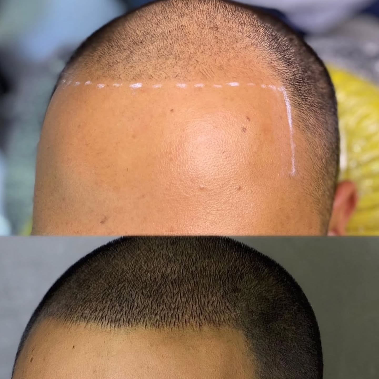 camilagodoy.nanocapilar Facebook ad: Olha esse antes e depois.