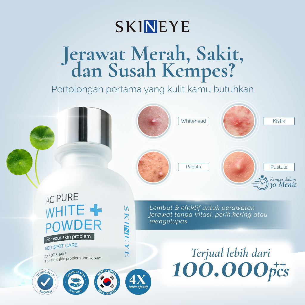 Skineye Id Facebook ad: Fase jerawat memang terkadang memakan waktu yang lama.