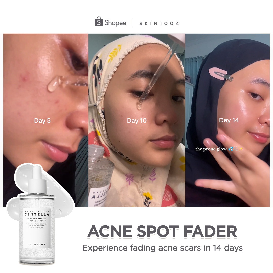 SKIN1004 Philippines Facebook ad