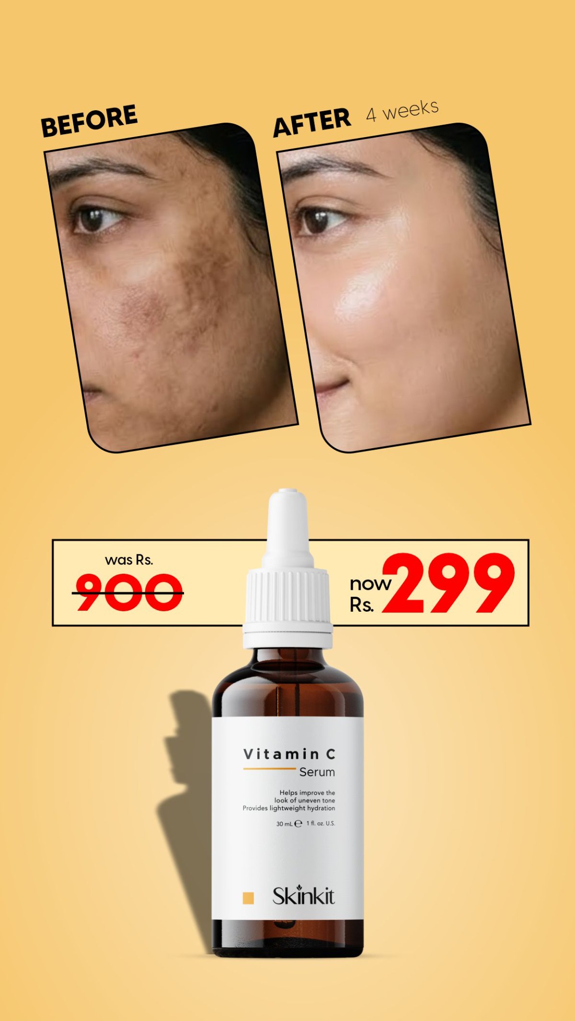 Skin Kit Facebook ad