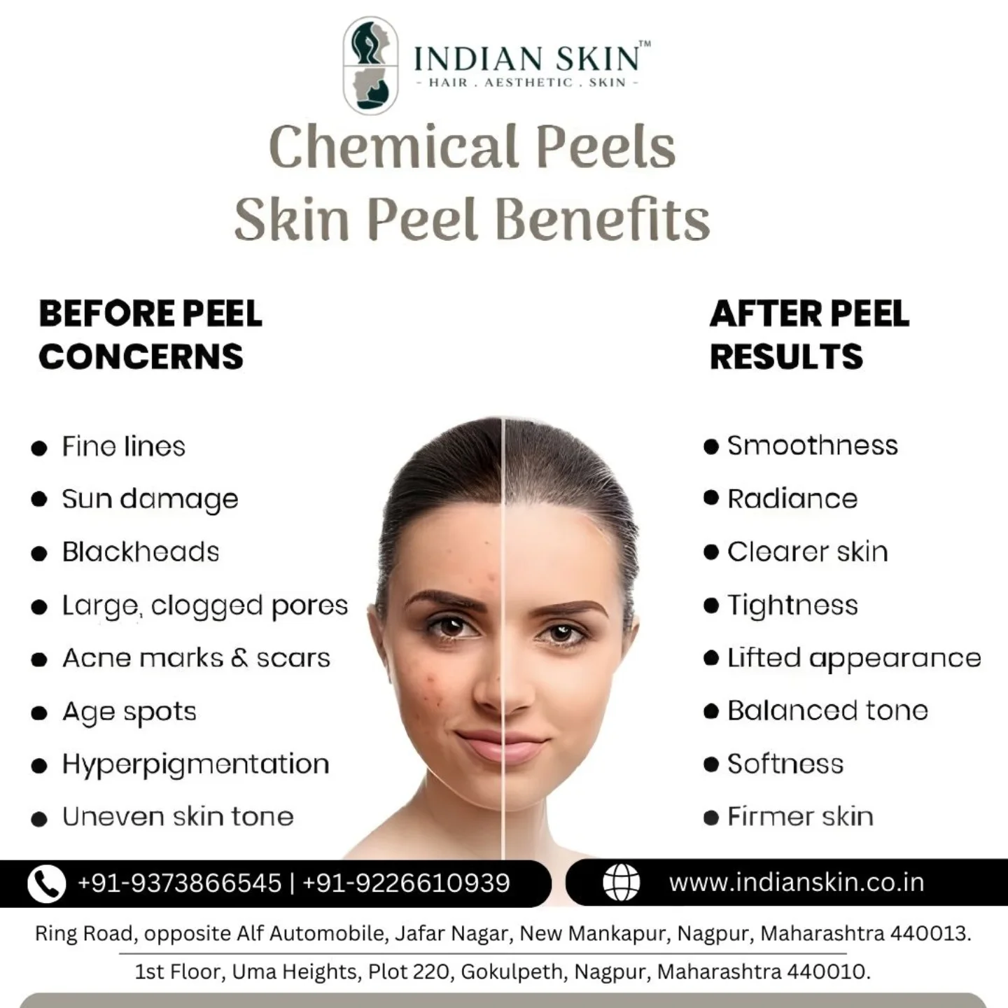 Indian Skin Facebook ad: At Indian Skin Clinic, we combine advanced technology…