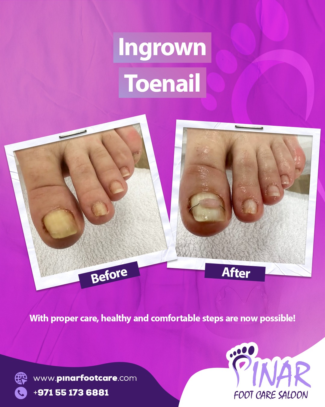 Pınar Foot Care Saloon Facebook ad