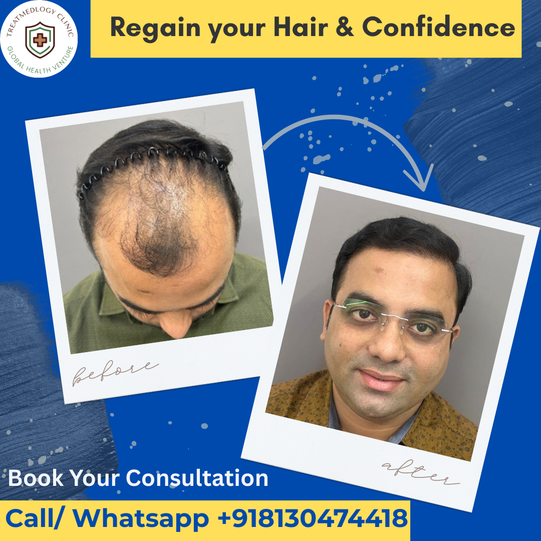 Dr. Samiksha Tyagi Facebook ad: Delhi's Trusted Hair Transplant Expert - Dr.