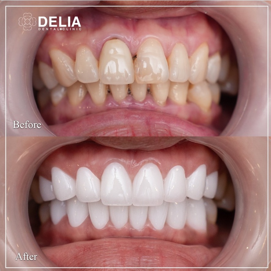 Delia Dental Clinic Facebook ad