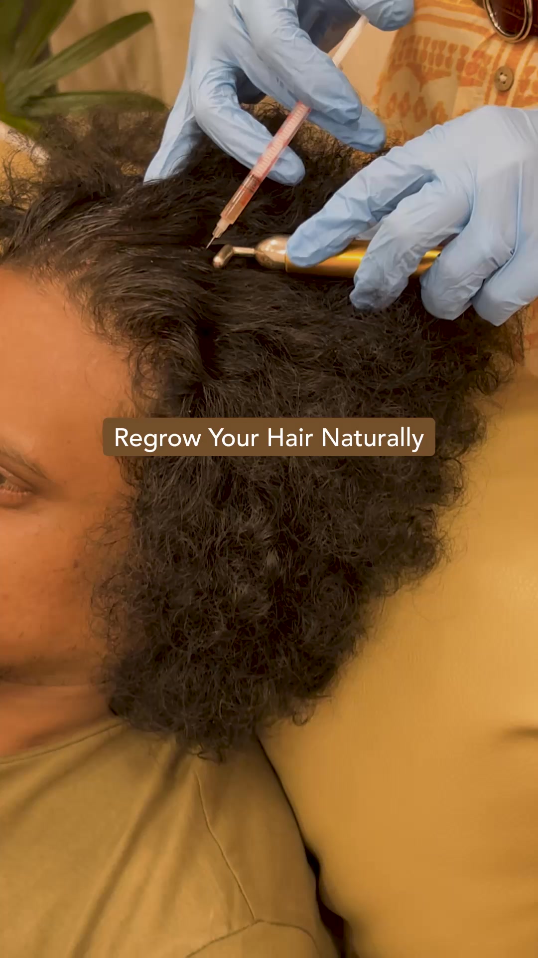 Welonaaesthetics Facebook ad: Struggling with Hair Loss?