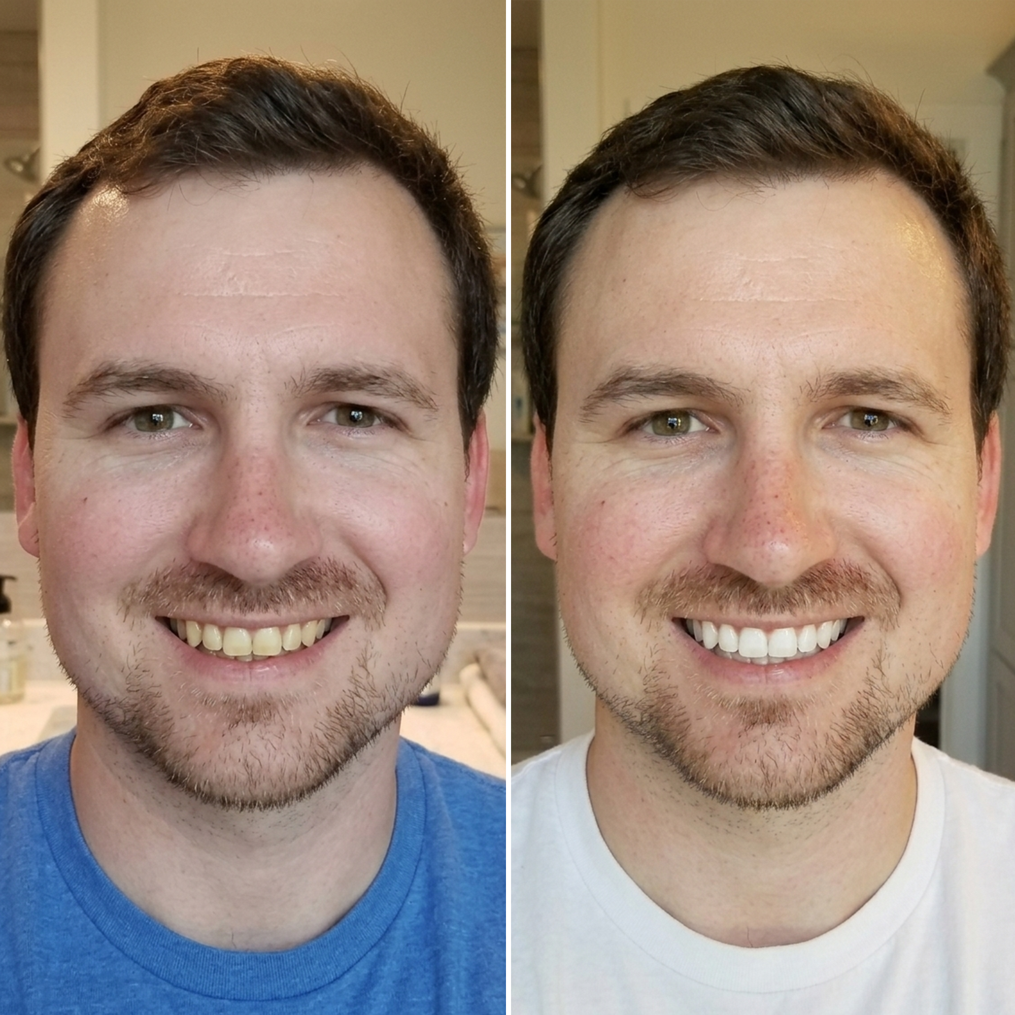 EBS Insider Facebook ad: The 2-Minute Whitening Trick That Works