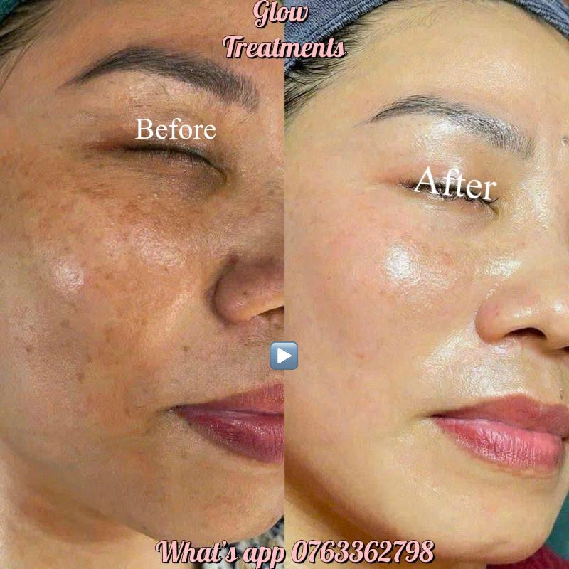 Glow Treatments Facebook ad: Glow Treatments Happy Customers