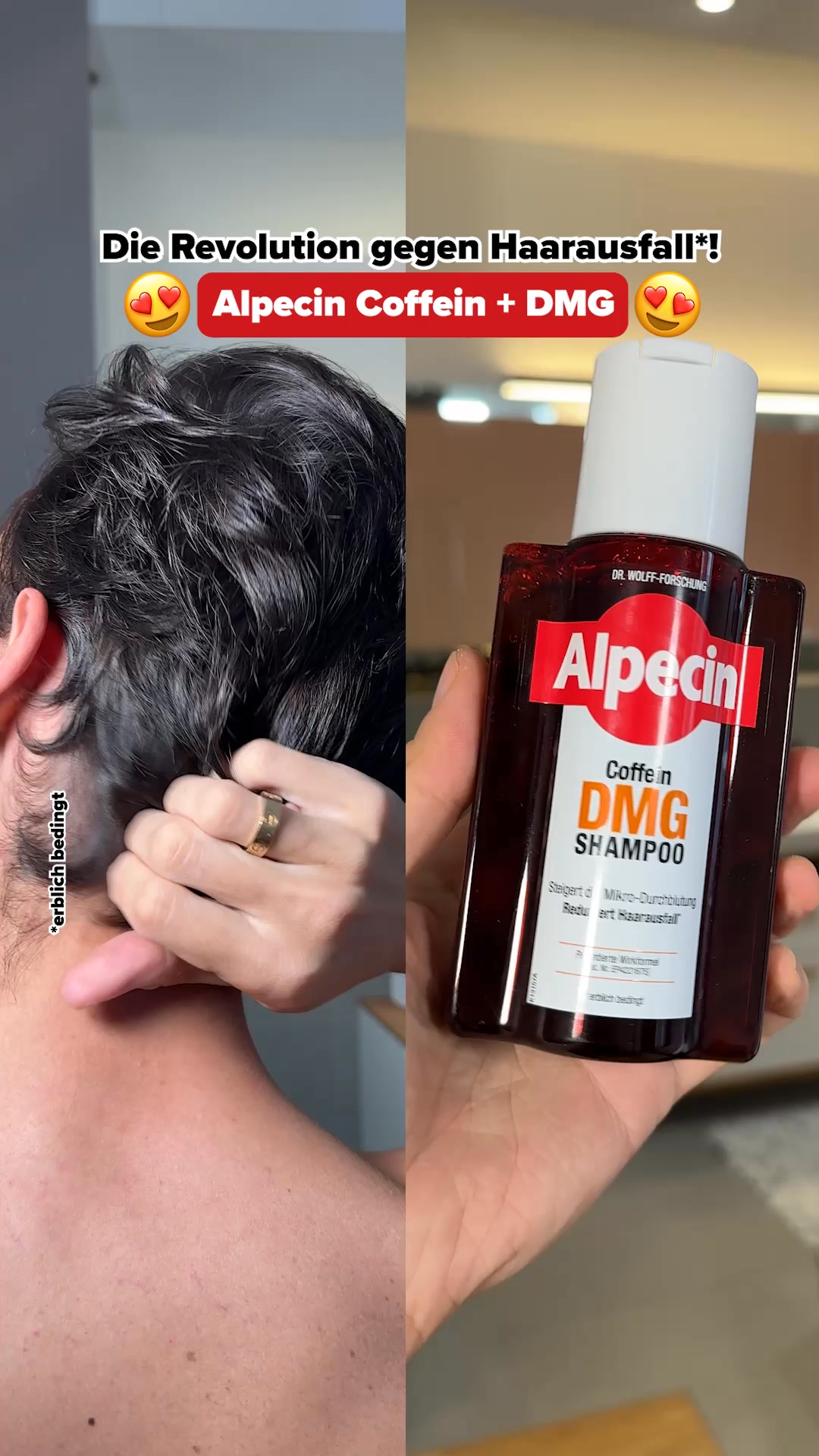 Alpecin Facebook ad: Coffein DMG Shampoo | Anti-Haarausfall-Shampoo