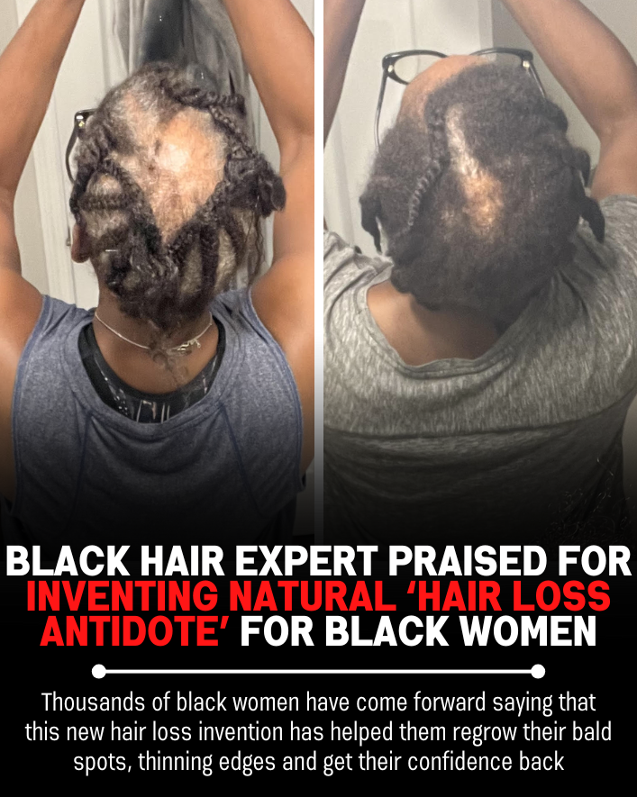 Black Hair Growth Remedy Facebook ad