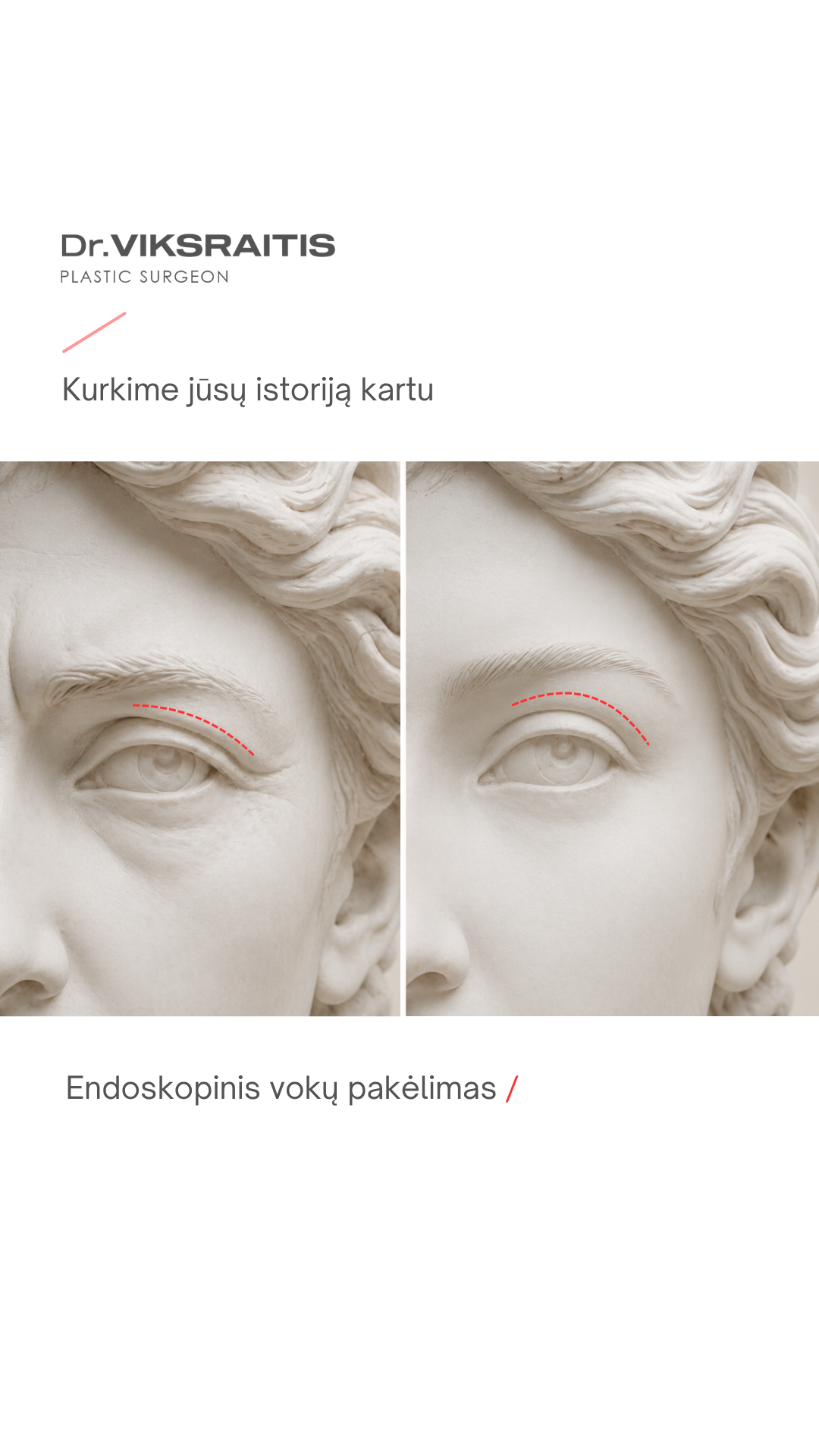 Plastikos chirurgas dr. Saulius Vikšraitis Facebook ad from May 28, 2026