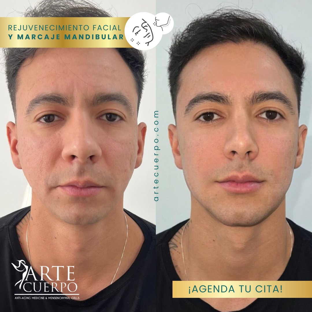 Clinica spa arte cuerpo  Facebook ad