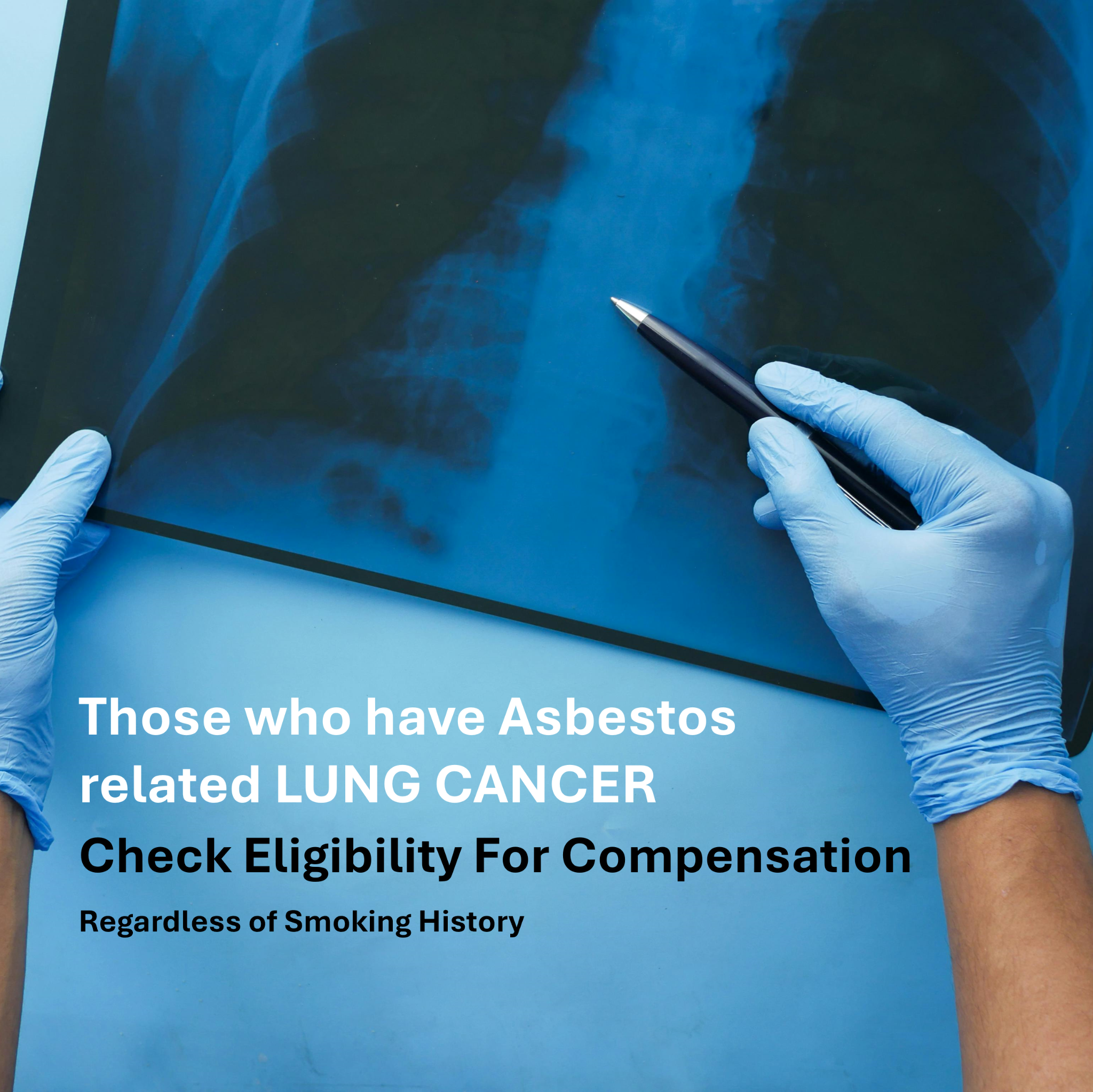 Keller, Fishback & Jackson, LLP Facebook ad: Lung Cancer Compensation