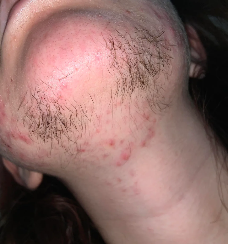Laura Bennett Facebook ad: Fix Your GLP-1 Hair Loss Today