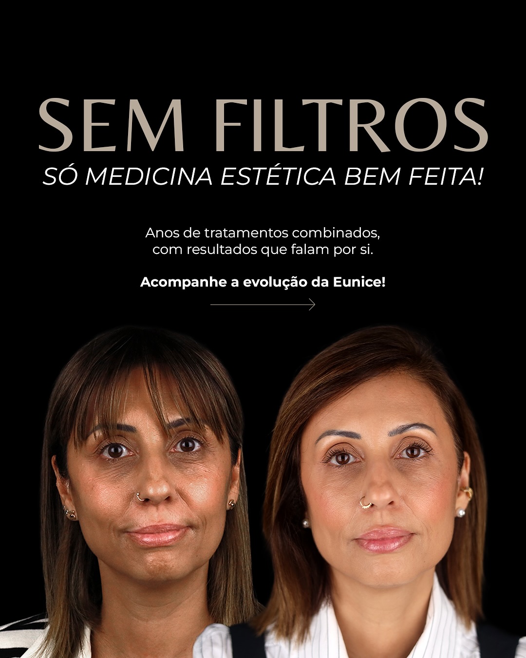 Face Mi - Instituto Médico da Face Facebook ad