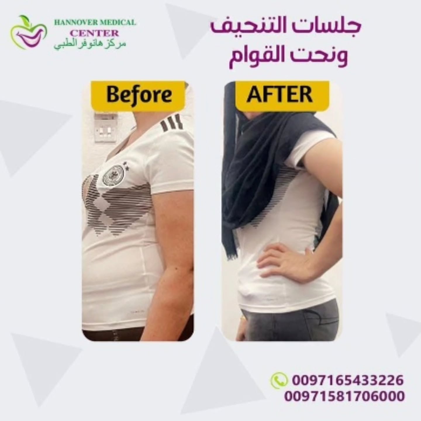 مركز هانوفر الطبي - الخان بالشارقة Facebook ad