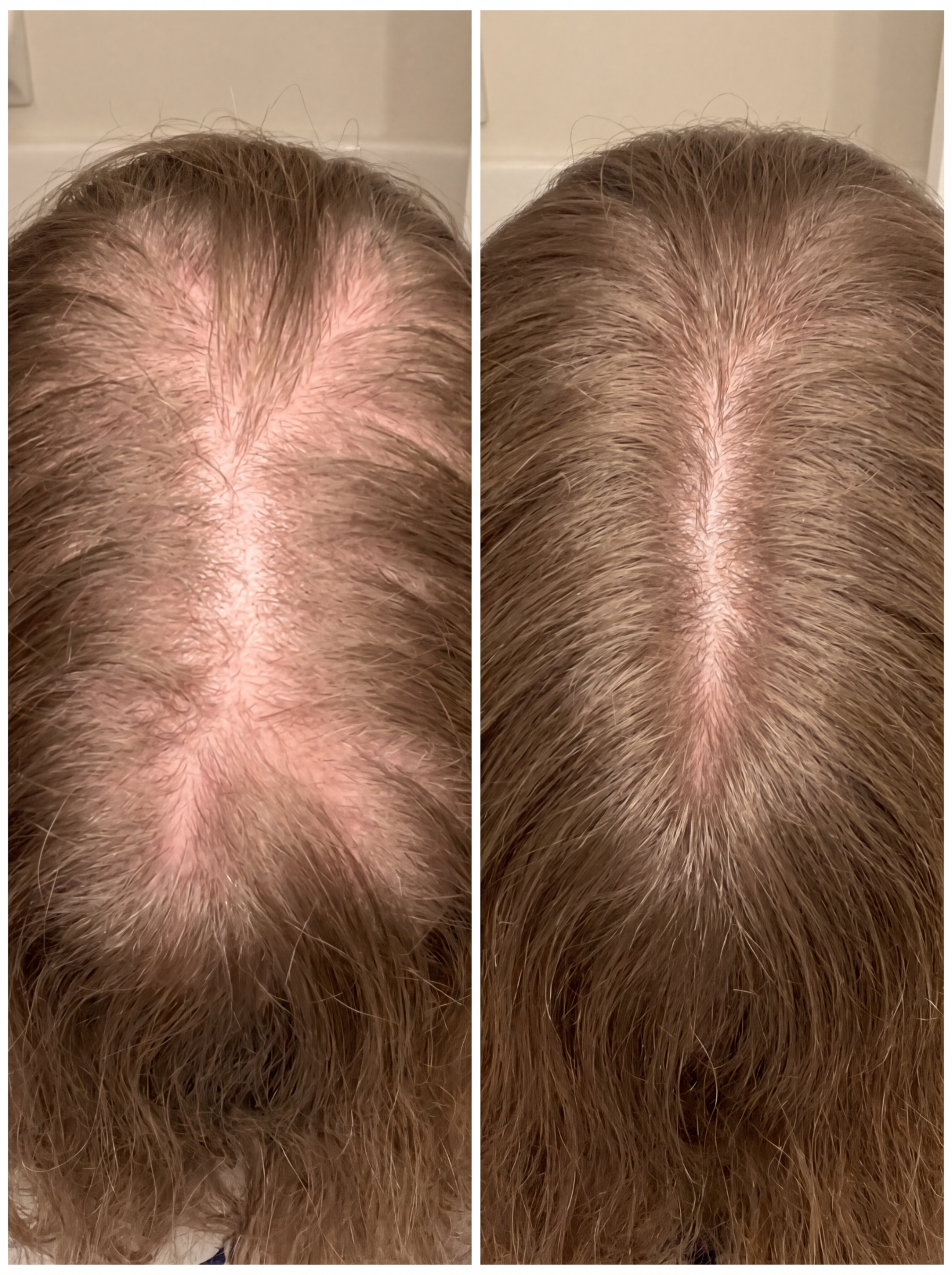 Soothbliss. Facebook ad: For Postpartum Hair Loss.