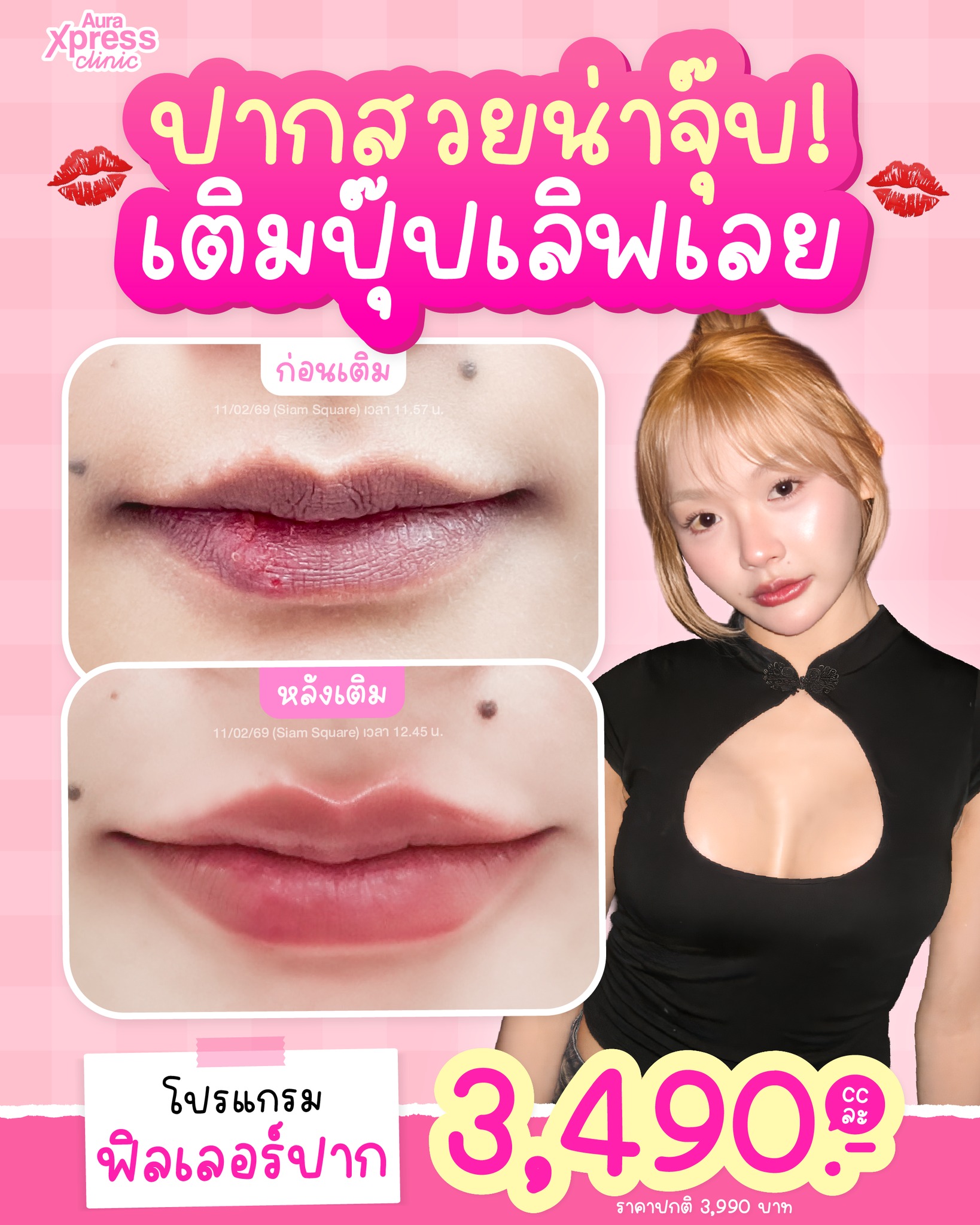 Aura Xpress Clinic Facebook ad: ปากสวยถูกใจตรงเรฟ กดเซฟเลย