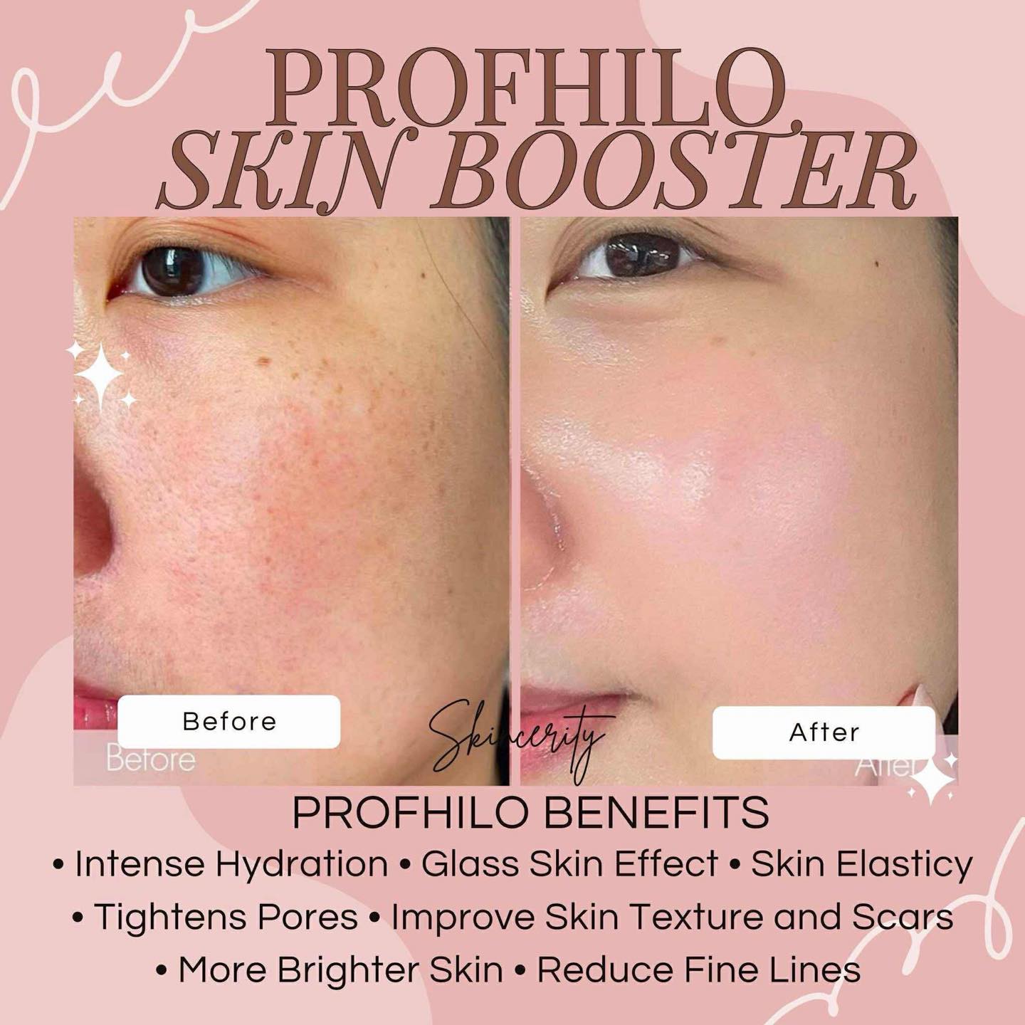 Skincerity Aesthetic PH Facebook ad: At Skincerity Aesthetic Clinic we offer