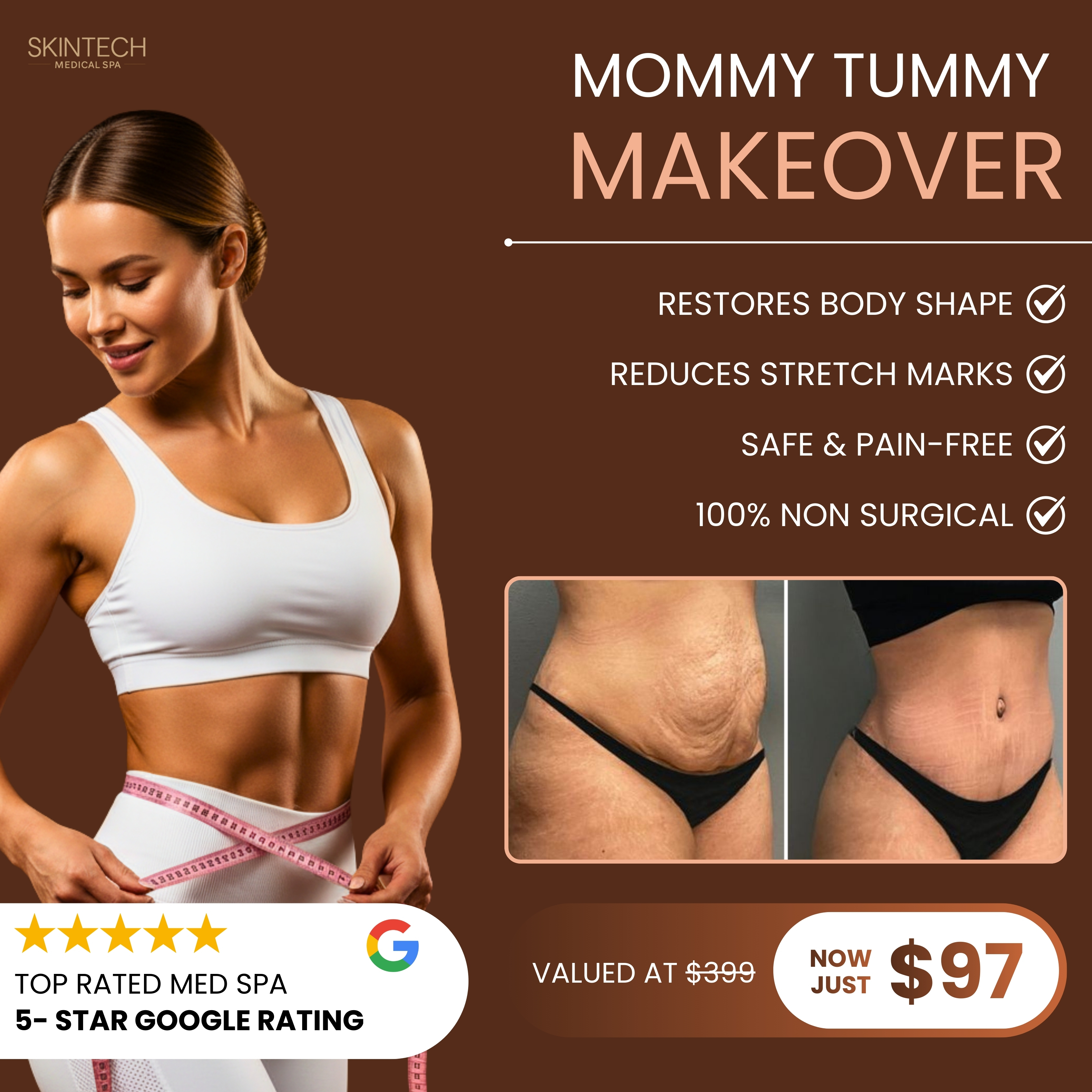 SkinTech Spa Facebook ad: Mommy Tummy Makeover - $97 (Reg. $399)