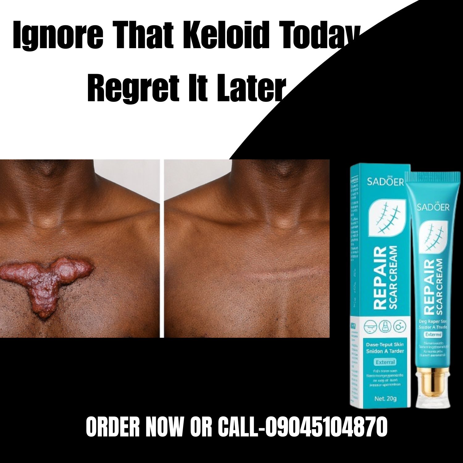Scar Repair Clinic Facebook ad