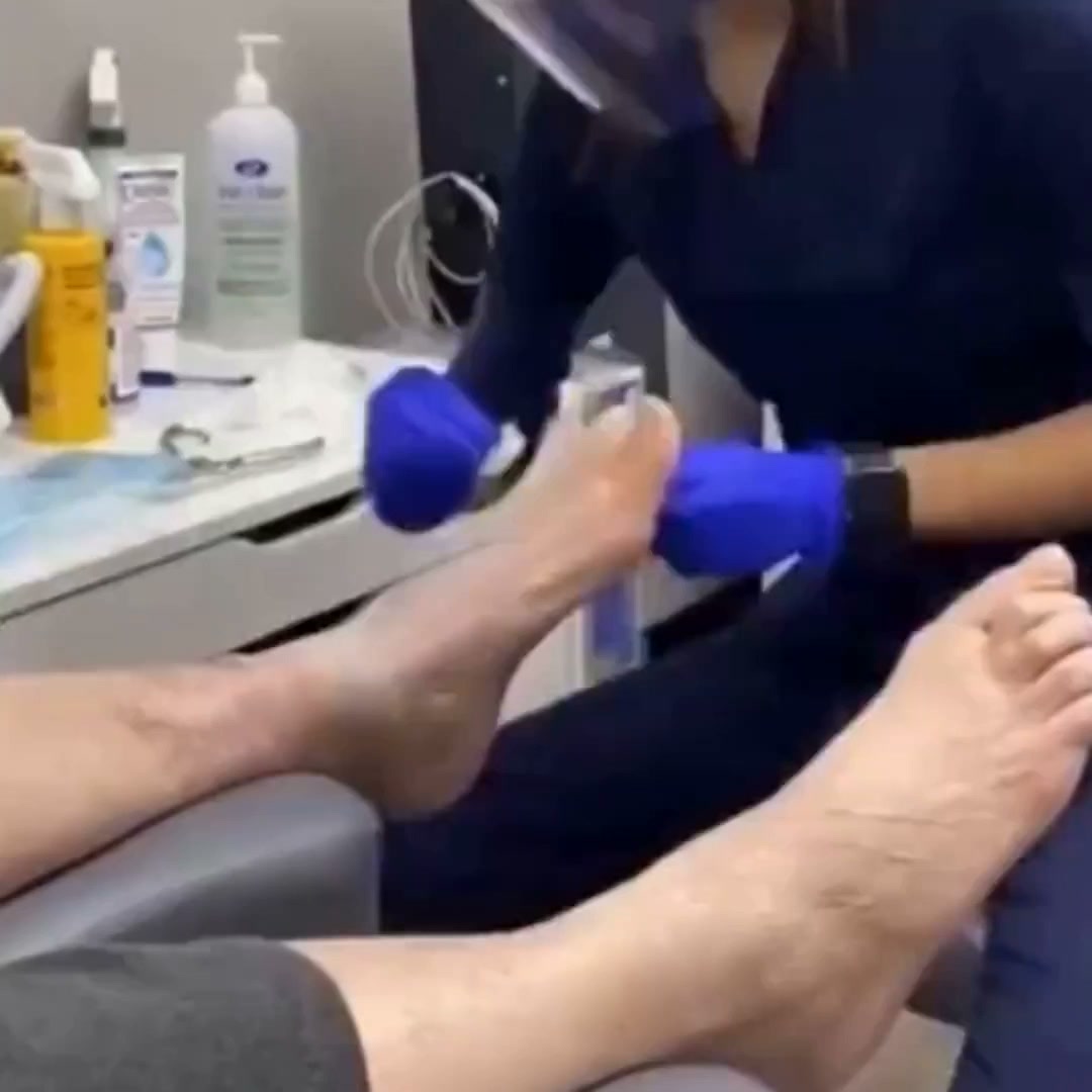 Wilson Health Services Burlington Facebook ad: Foot Care, Ingrown Toenails, Orthotics. Contact today