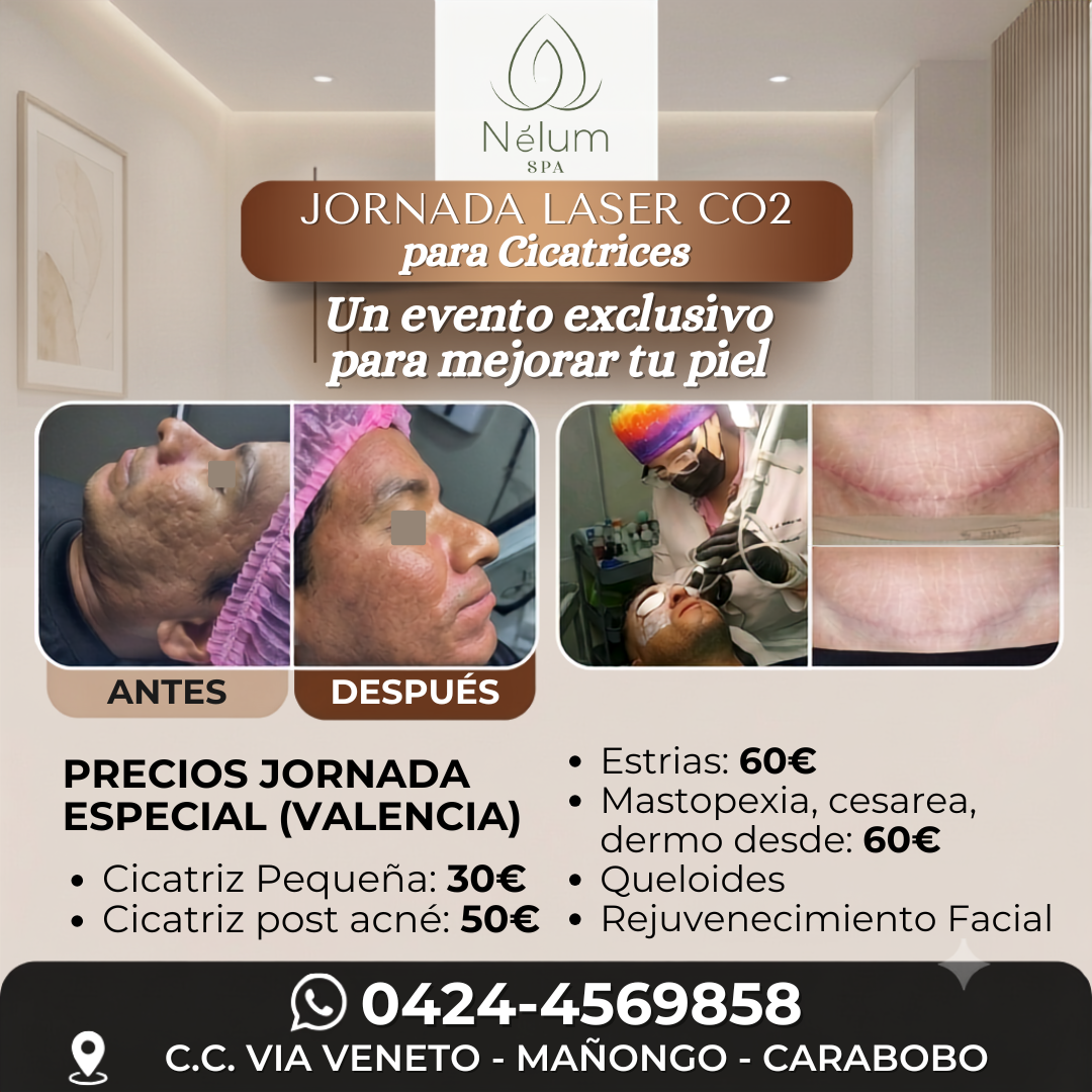 Nelum Spa Facebook ad: Chatea con nosotros