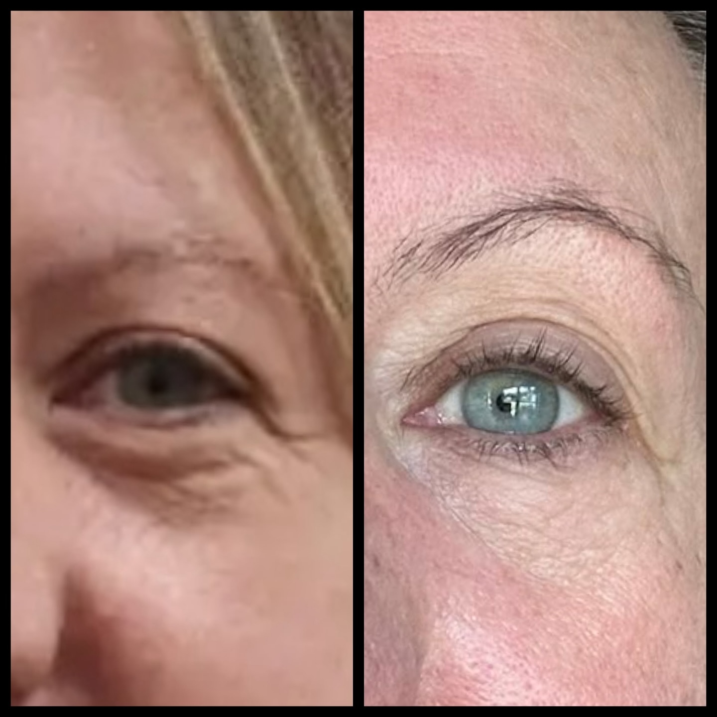 Flourish Wellness Facebook ad: Lines softened. Lids lifted.