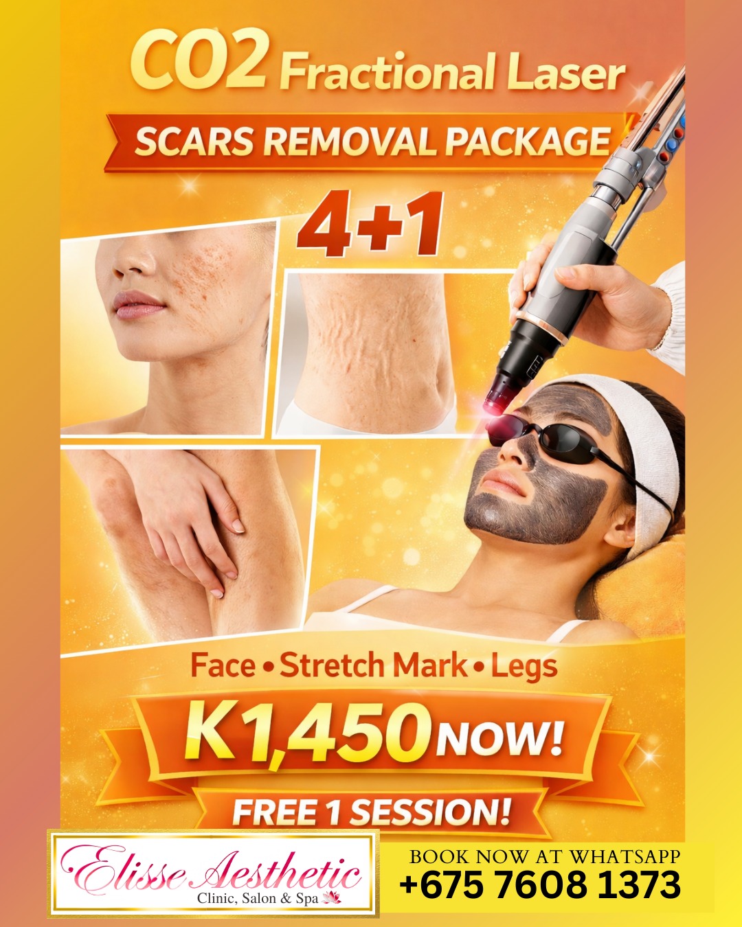 Elisse Aesthetic Clinic, Salon & Spa Facebook ad: CO2 Fractional Laser Scar Care Package, March Offer