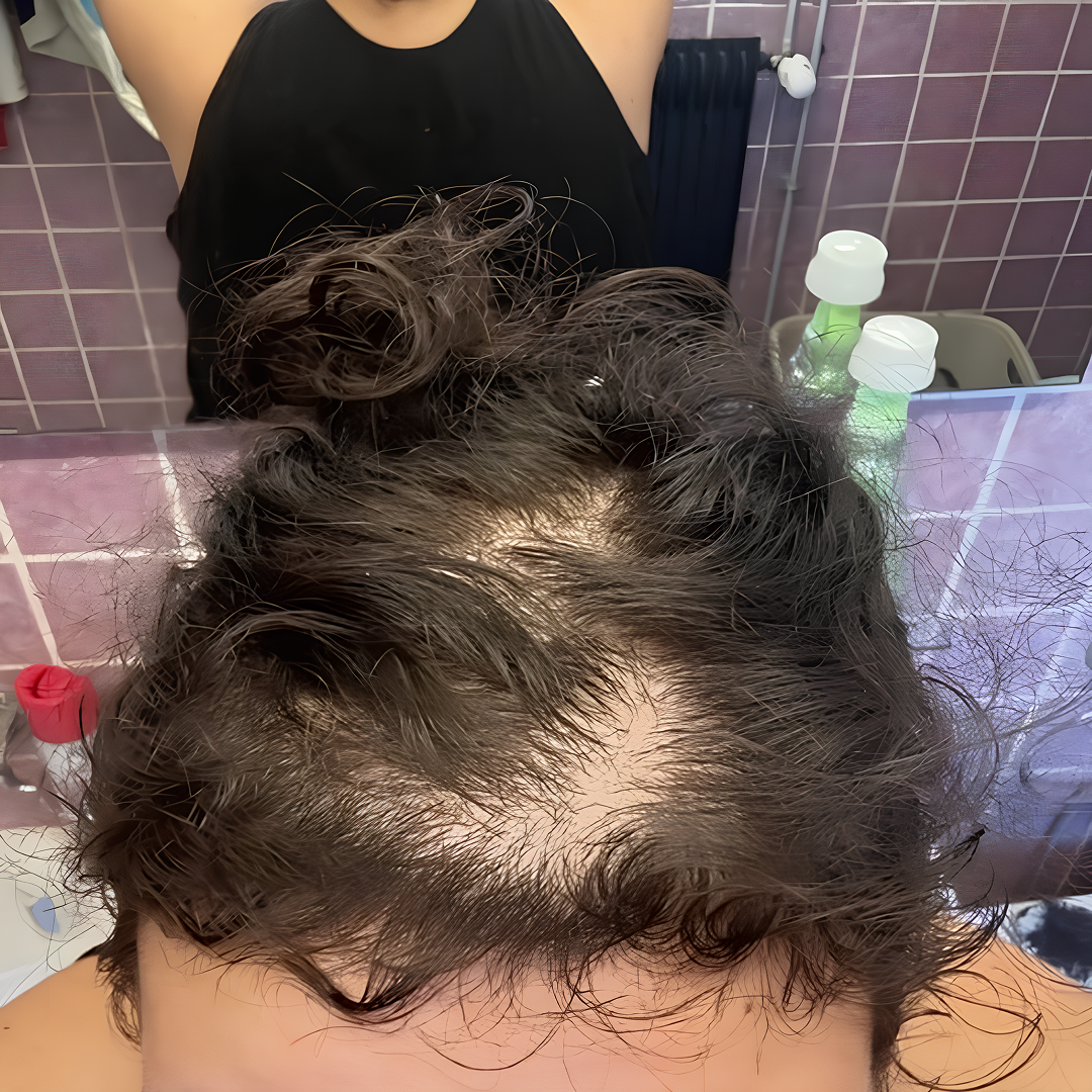 Jennifer Nelson Facebook ad: Reverse GLP-1 Hair Loss