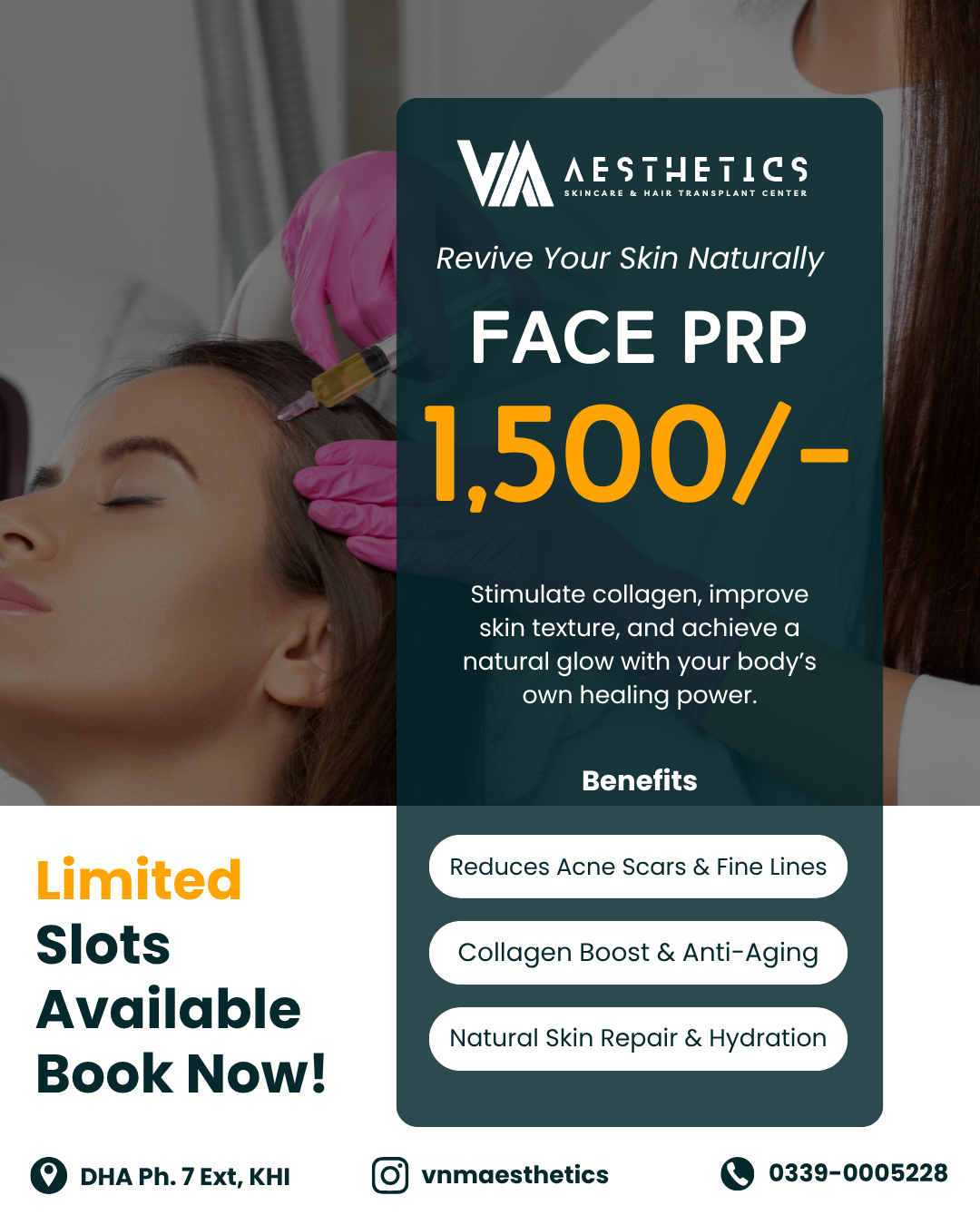 VNM Aesthetics Facebook ad: Face PRP Treatment