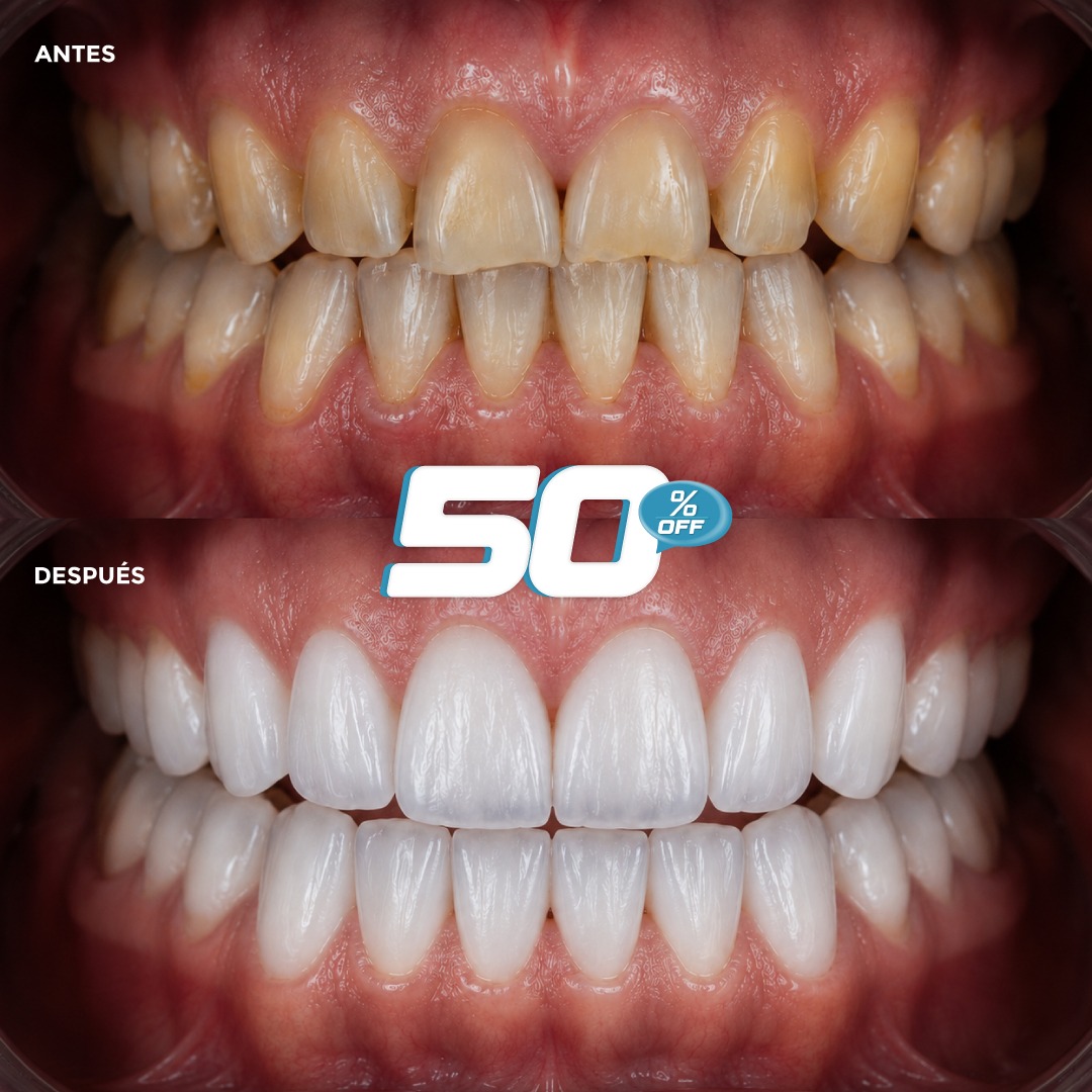 GREDY Dental Center Facebook ad