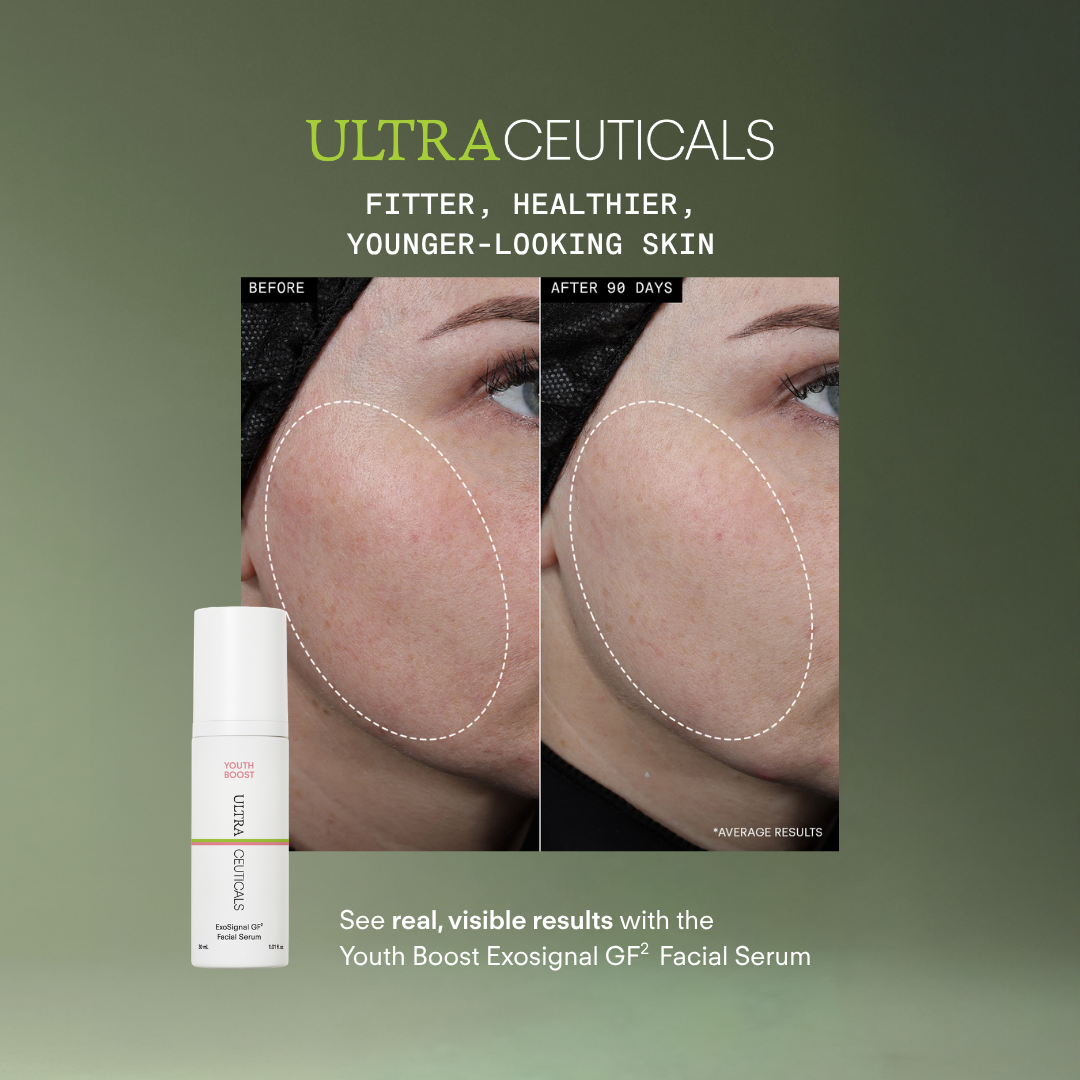 Ultraceuticals Facebook ad