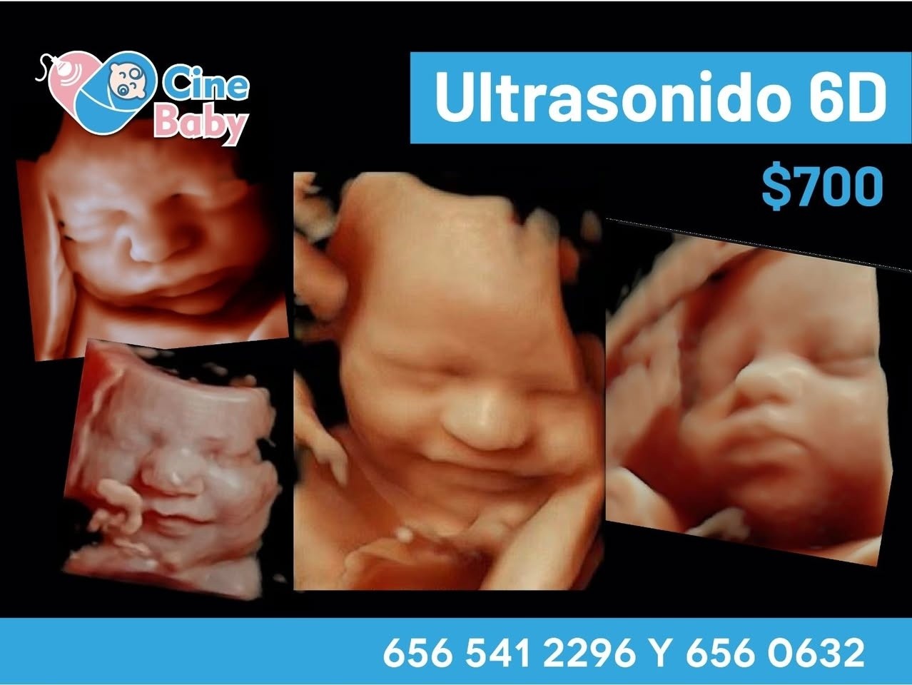 Unidad de Especialidades Medicas San Antonio Facebook ad: CINE BABY VIP