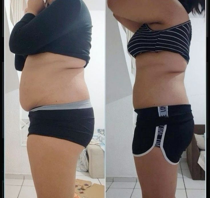 Lynae Facebook ad