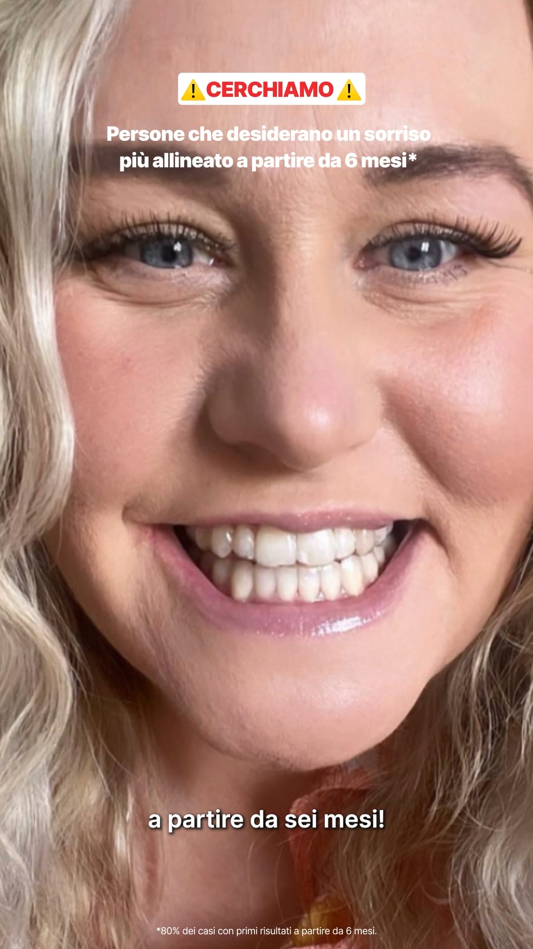 Impress_it Facebook ad: Nuovo sorriso con Invisalign