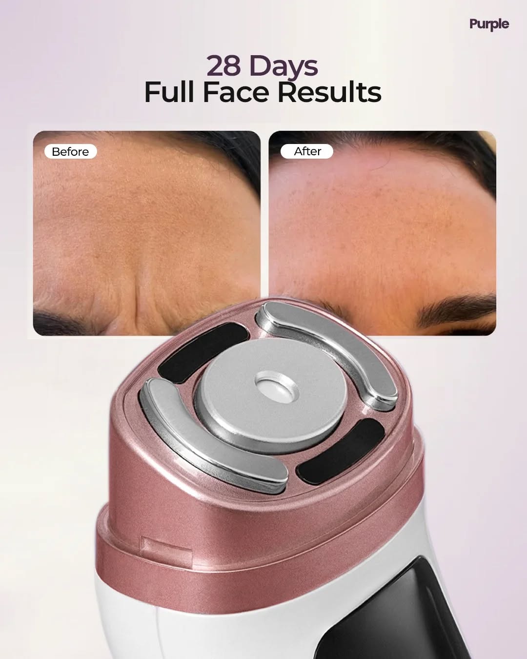 GoPurple Facebook ad: Best HIFU anti wrinkle device in pakistan