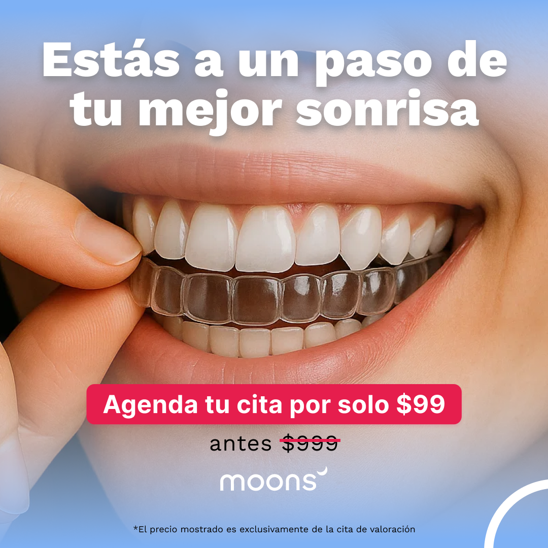 moons Facebook ad: Ortodoncia Invisible Sin Brackets