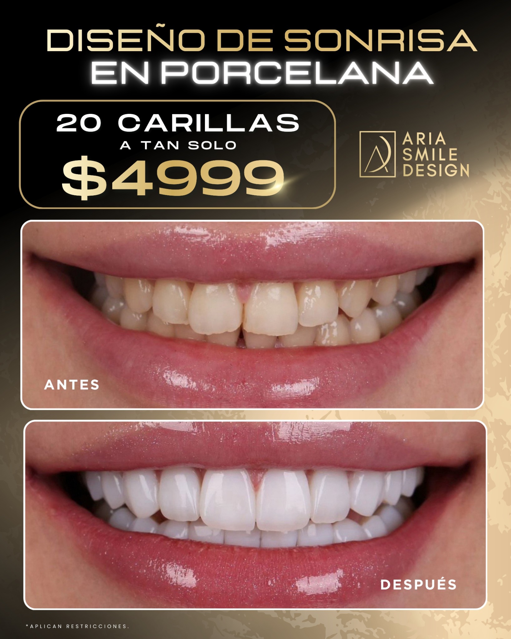 Aria Smile Design Facebook ad