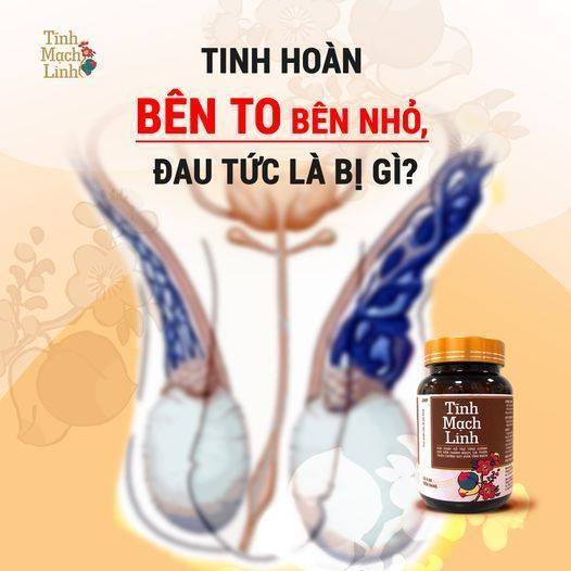 Tĩnh mạch linh - giãn tĩnh mạch thừng tinh Facebook ad: T!NH HOÀ.N BÊN TO BÊN NHỎ, ĐAU TỨC…