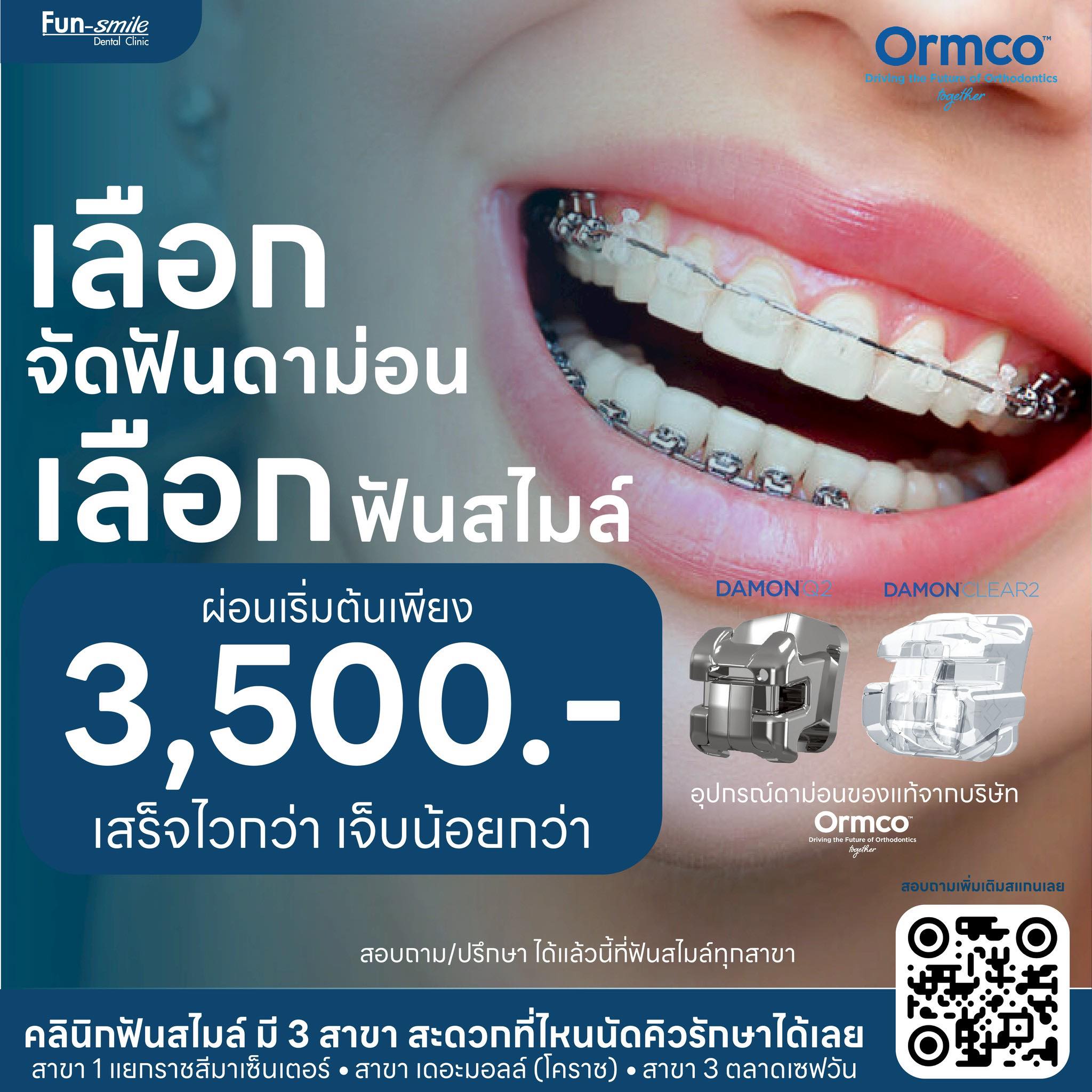คลินิกฟันสไมล์ จัดฟัน จัดฟันใสโคราช ฟอกสีฟัน รากฟันเทียม วีเนียร์ ฟันปลอม Facebook ad