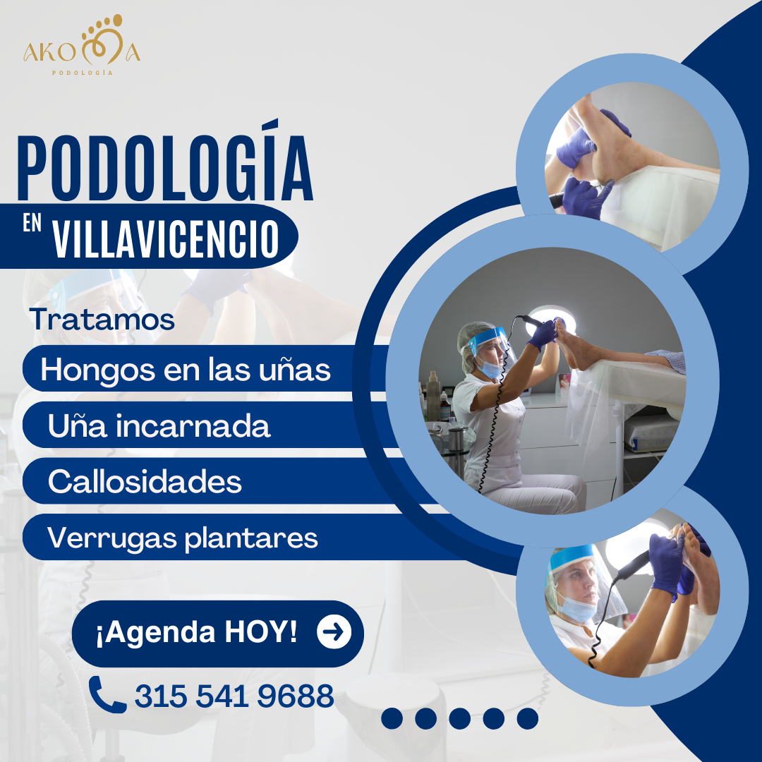 Akoma Podología Facebook ad