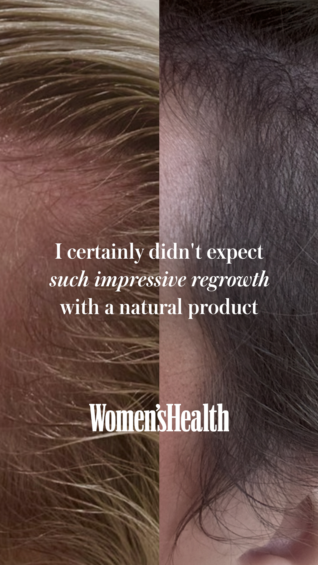 Chāmpo Haircare Facebook ad