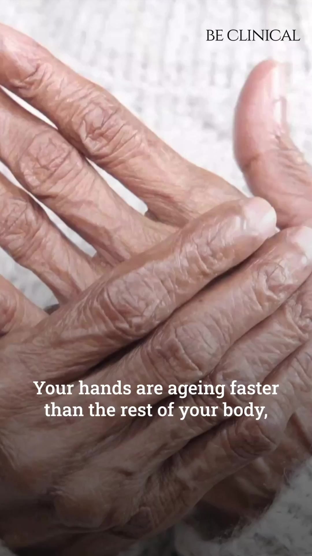 Be Clinical Facebook ad: Say Goodbye to Dry, Wrinkled Hands, Hello Youthful Softness!
