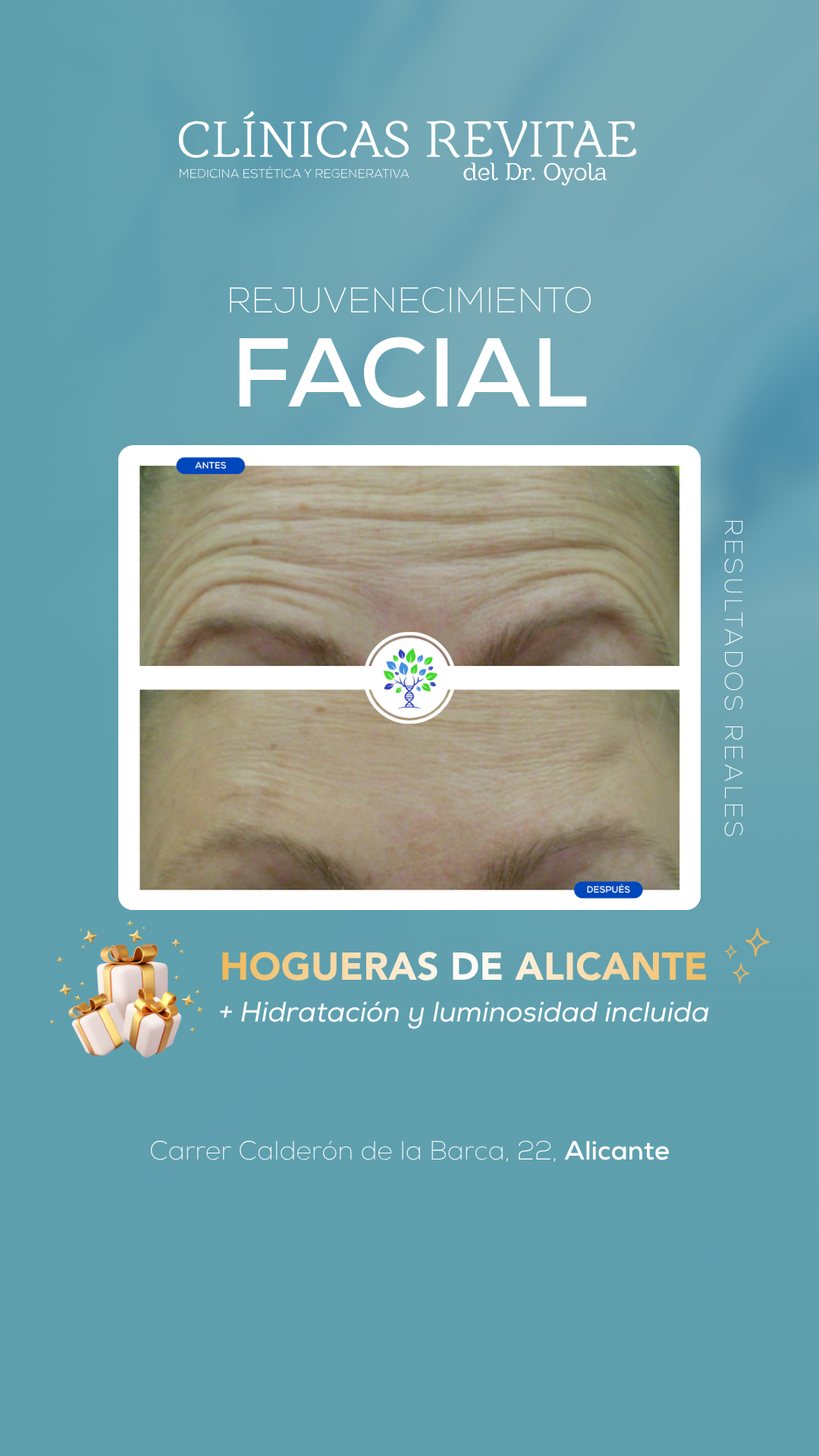 Clínicas Revitae Facebook ad