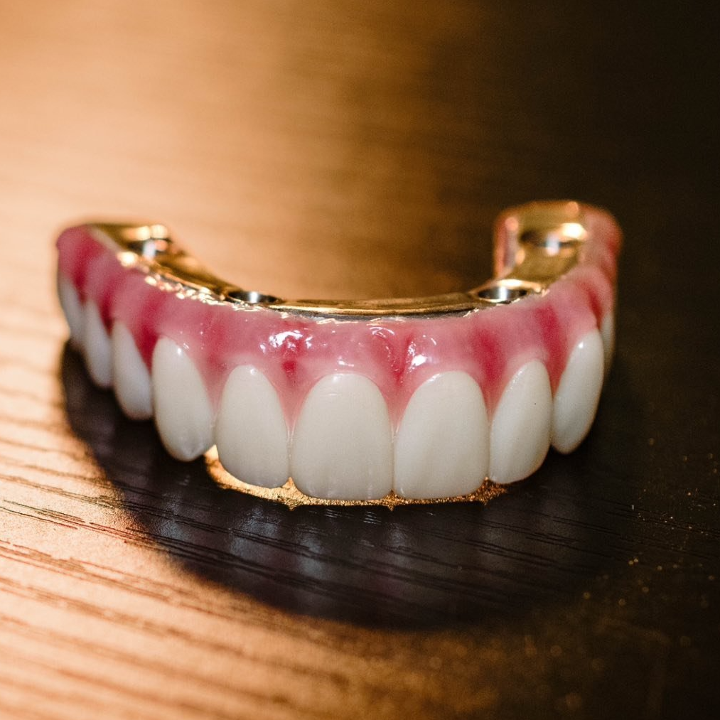 Nuvia Dental Implant Center Facebook ad