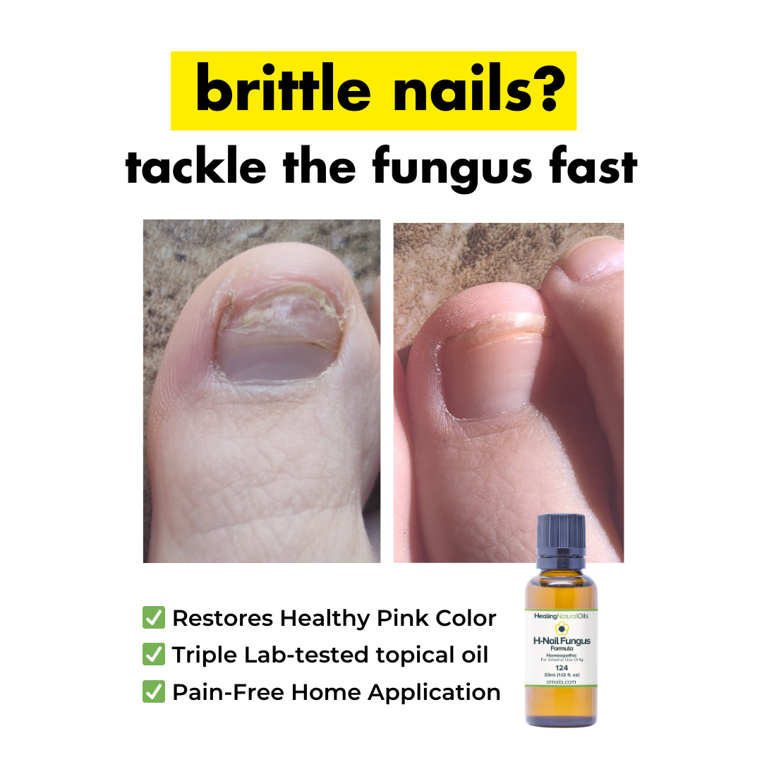 Healing Natural Oils Facebook ad