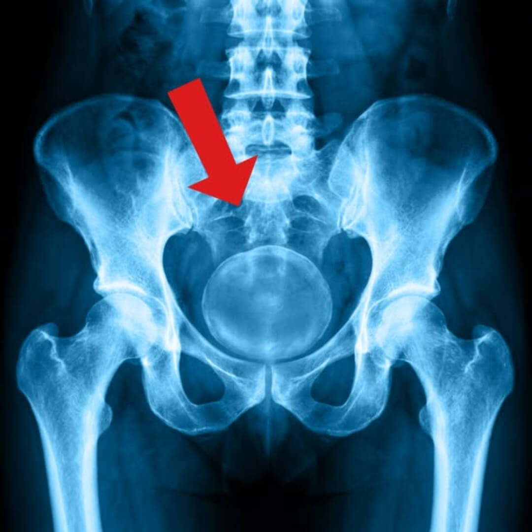 Dr. Tracy Gapin Facebook ad: After 20 years in men's health, I can…