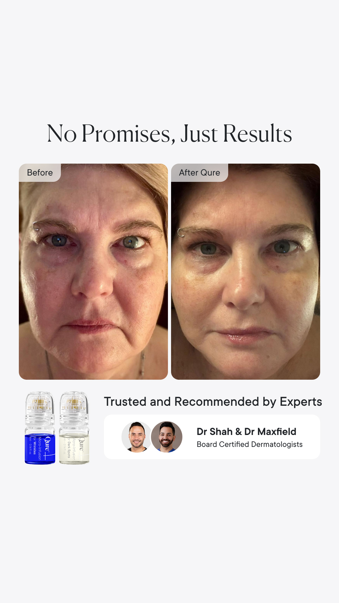 Qure Skincare Facebook ad